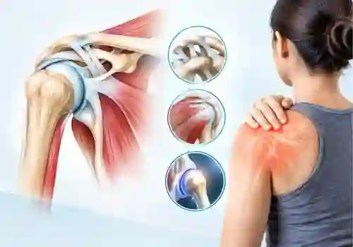 shoulder-joint-anatomy-pain-movement-treatment